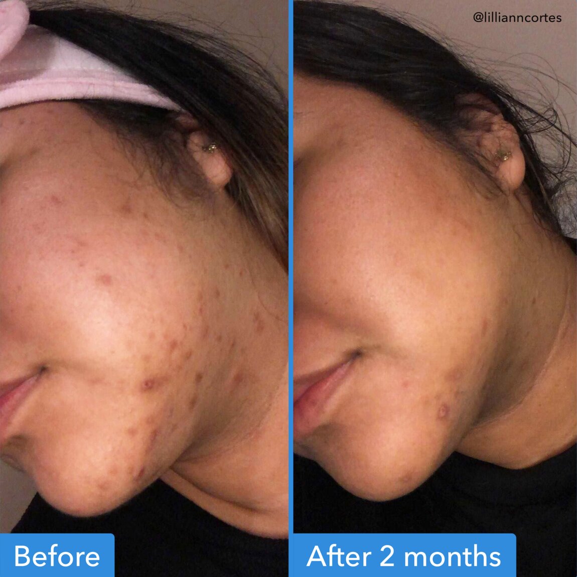 discoloration-correcting-serum-f7 zb_p.jpg