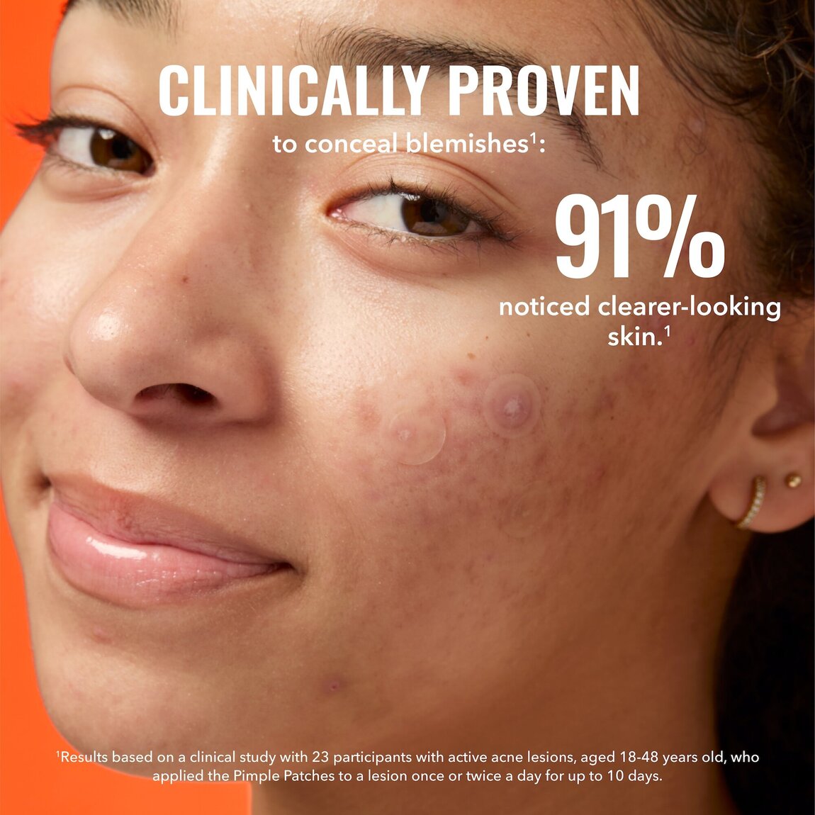 pimple-patches-q1 zb_p.jpg