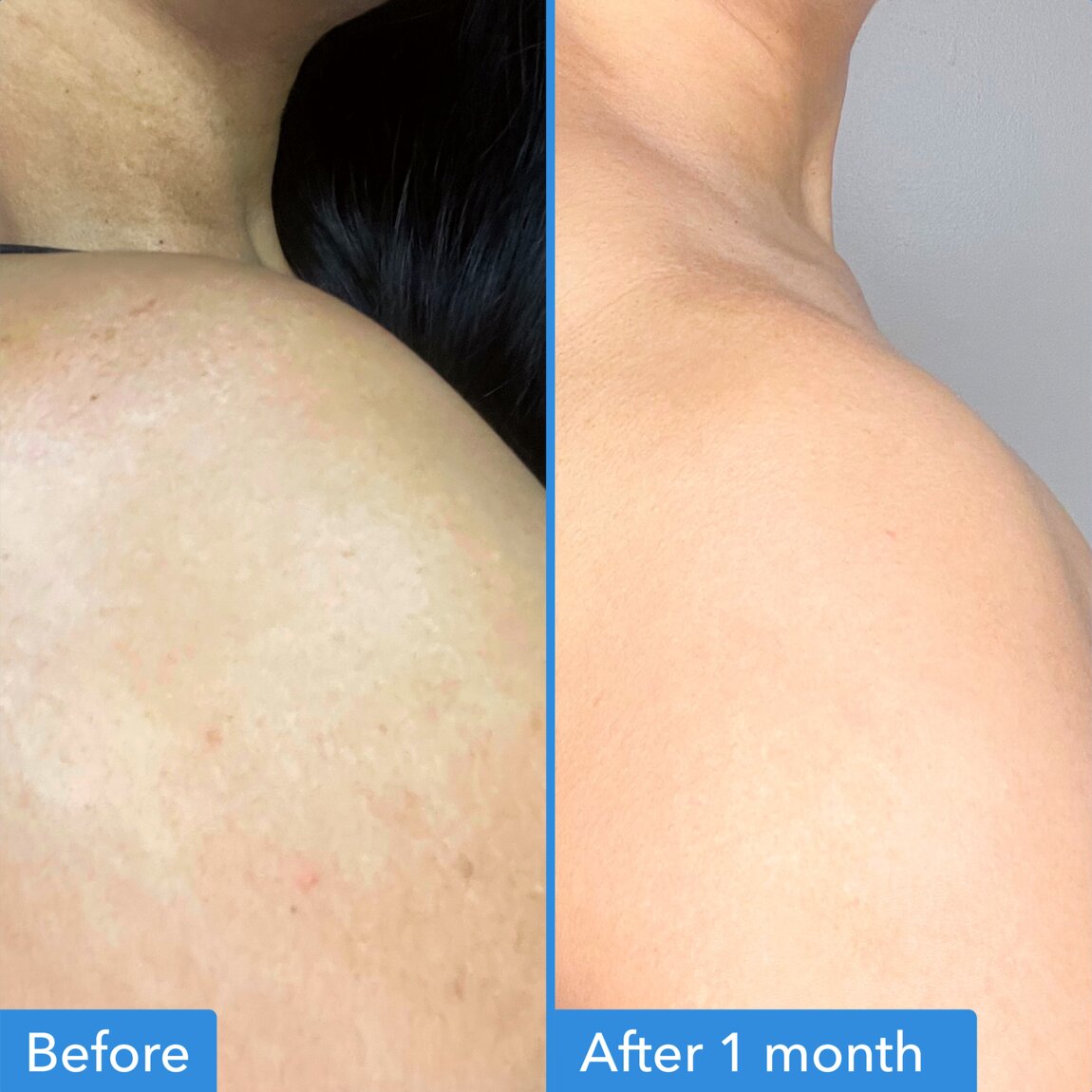 discoloration-correcting-body-treatment-h7 zb_p.jpg