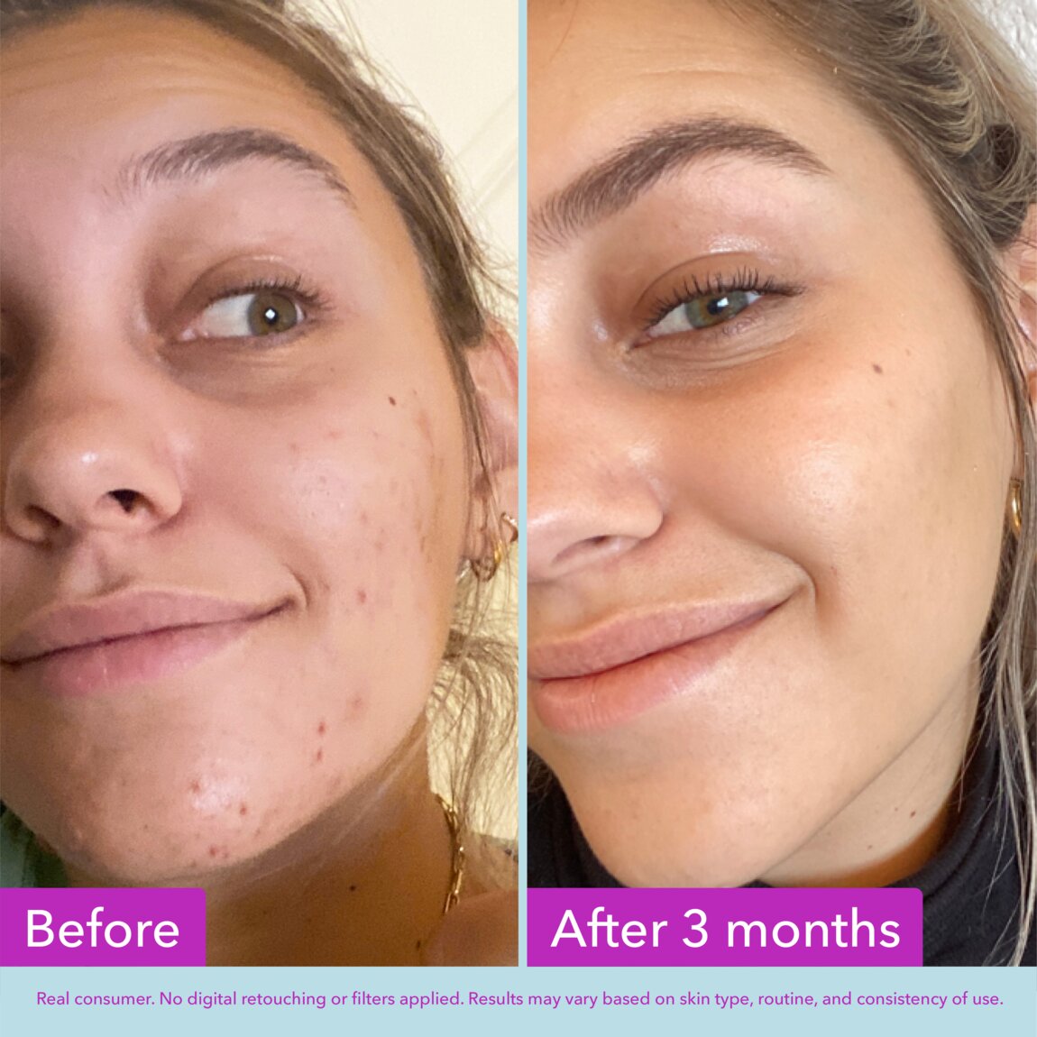 niacinamide-brightening-toner-d1 zb_p.jpg