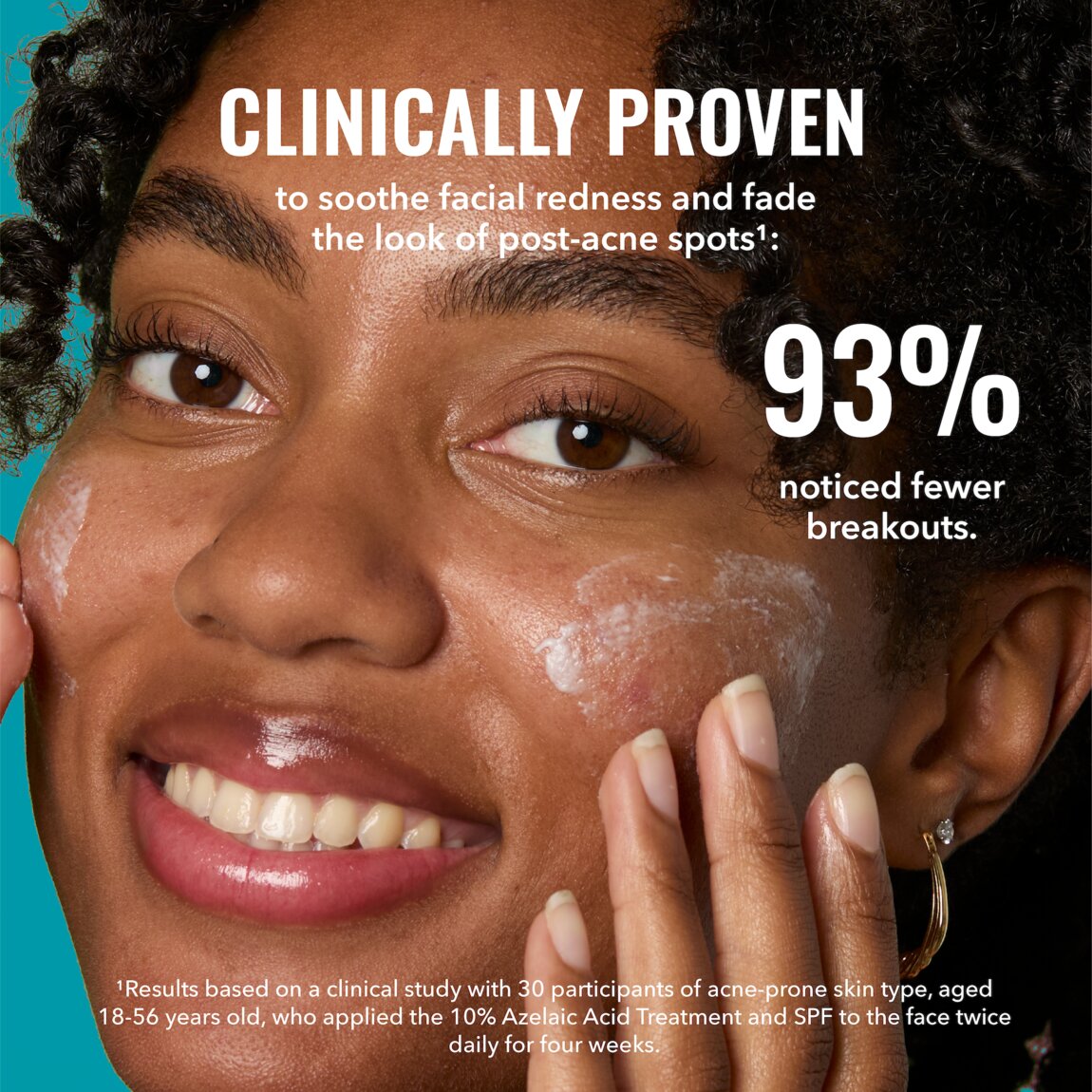 10-azelaic-acid-treatment-a5 zb_p.jpg